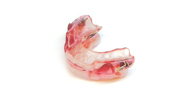 いびきのマウスピース・分離型マウスピース