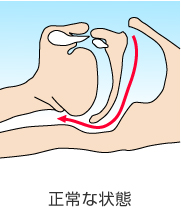 ���т��̌����E����ȏ�Ԃ̈�������