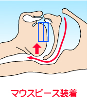 ���т��Ɩ��ċz�ǌ�Q�̋C�����J���}�E�X�s�[�X�E�X���[�v�X�v�����g