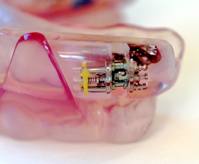 ���т��p�E���ċz�ǌ�Q�̐����}�E�X�s�[�X�E�����^�̍\��