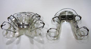 顎を拡げる矯正装置・拡大矯正