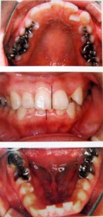 �q���̊{���g���鋸�����u�E�g�勸���O